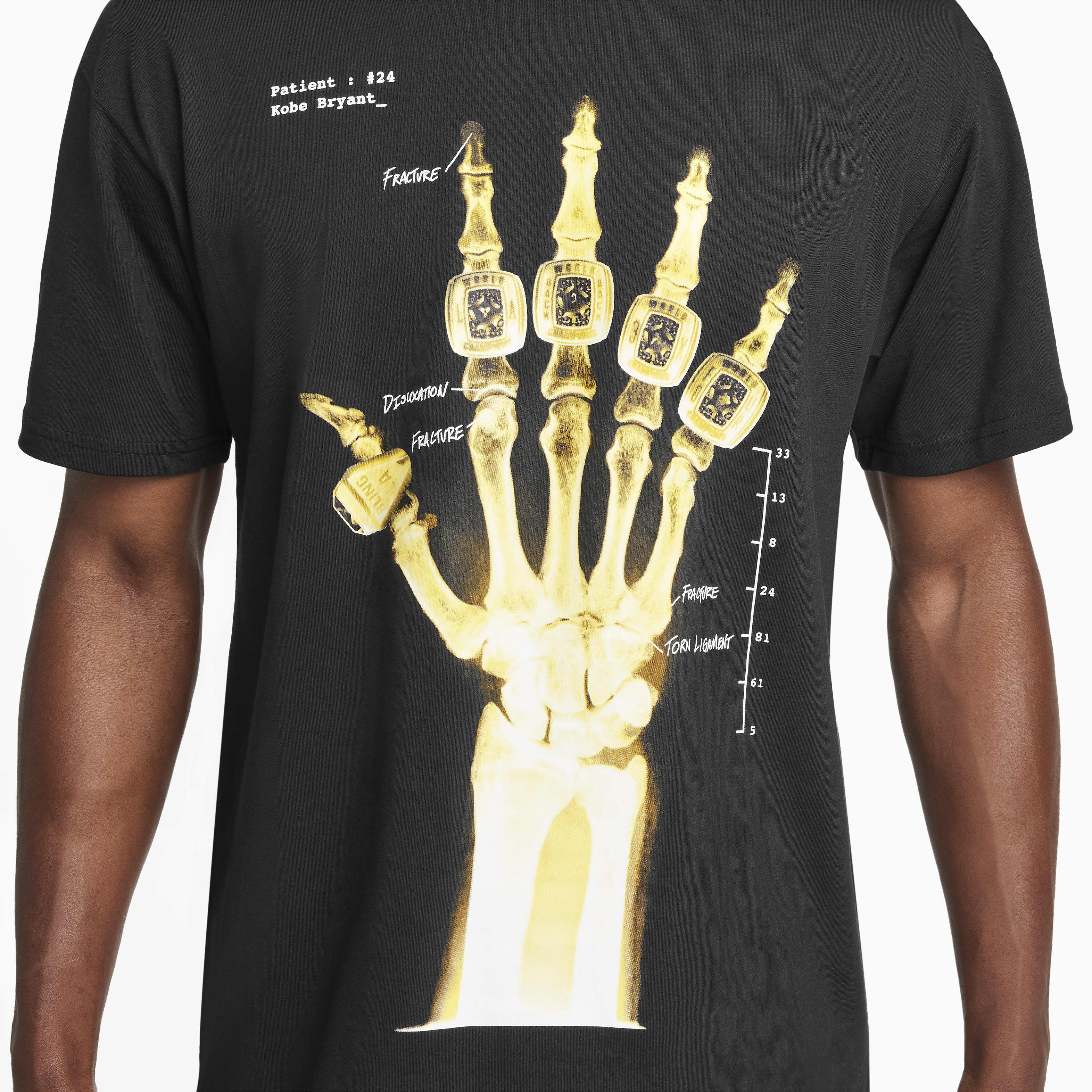 Kobe 'X-Ray' image number 3